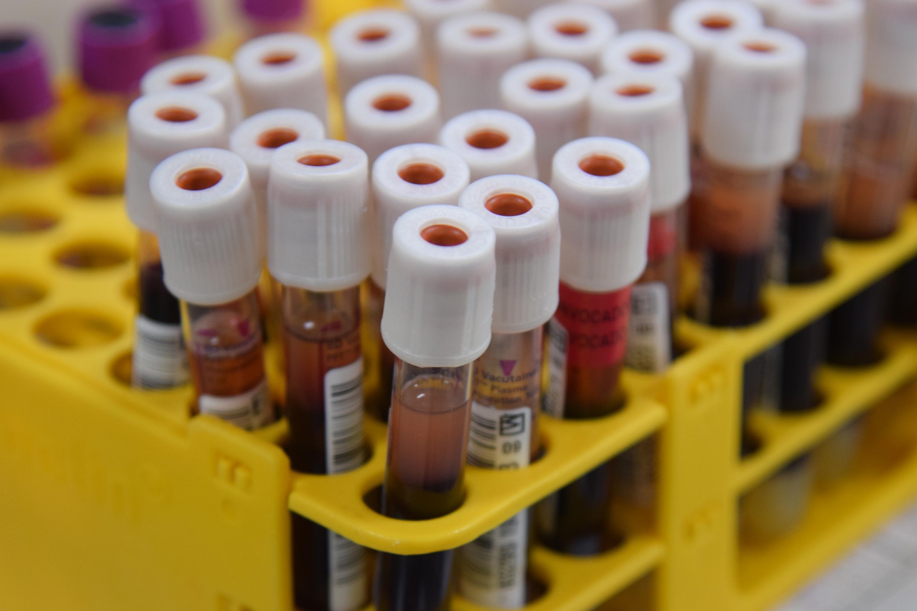 Junho Vermelho: sistema do Hemepar é destaque nacional em rastreamento de sangue