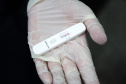 Saúde envia mais 464 mil testes para diagnóstico da Covid-19
