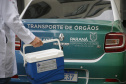TRANSPLANTE