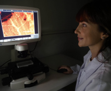 Matéria especial Samar - HPV UEM