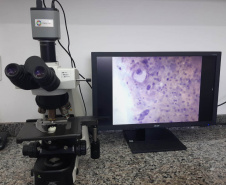 Exame para a detecção do câncer de colo de útero é disponibilizado gratuitamente no Paraná