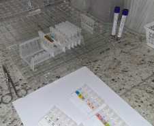 Tratamento especializado ofertado pelo Hemepar amplia qualidade de vida de pacientes com Anemia Falciforme e Talassemia