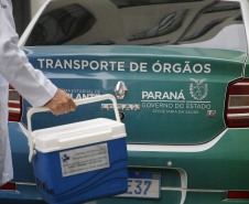 TRANSPLANTE