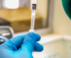  Lacen processa 13.298 amostras para vírus respiratórios em seis meses