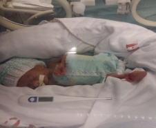 SESA PAIS DE UTI BEBES PREMATUROS
