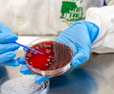 SESA Doenças do estômago e intestino já afetou mais de 389 mil paranaenses este ano