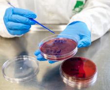 SESA Doenças do estômago e intestino já afetou mais de 389 mil paranaenses este ano