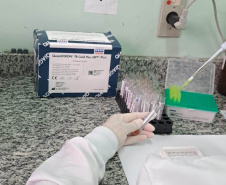  Controle da tuberculose tem importante avanço no Paraná com aumento de 43% no tratamento preventivo