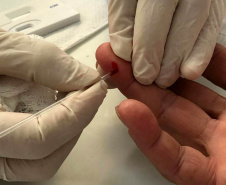 A Secretaria da Saúde do Paraná promove neste mês diversas ações da campanha Julho Amarelo, que visa conscientizar a população sobre a prevenção e tratamento das hepatites virais. Uma das principais atividades aconteceu nesta quinta-feira (25), em Curitiba, com a oferta de testes rápidos para diagnóstico das hepatites B e C. Foto: Divulgação/SESA