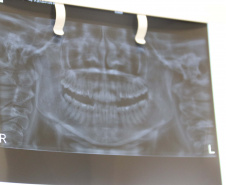 Polícia Científica e CRO iniciam campanha sobre a identificação humana pela Odontologia ForenseFoto:SESP