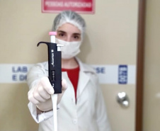 A Universidade Estadual de Maringá (UEM) está desenvolvendo um estudo inédito sobre novos tratamentos para a toxoplasmose, popularmente conhecida como doença do gato. Não contagiosa, a infecção é adquirida pela ingestão de água ou alimentos contaminados pelo protozoário Toxoplasma gondii.  - Foto: UEM