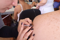 Paraná forma médicos da Atenção Primária para atuar com acupuntura no SUS