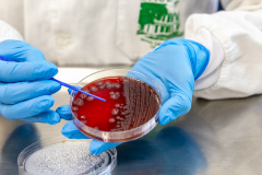 SESA Doenças do estômago e intestino já afetou mais de 389 mil paranaenses este ano