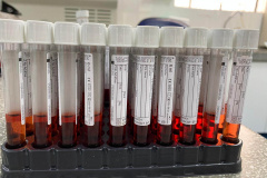 CPPI  produziu mais de 100 mil tubos para transporte viral dos testes da Covid-19. Foto:SESA