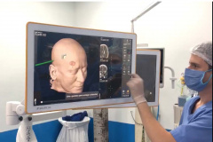 
Foi realizada hoje (12), no Complexo do Hospital do Trabalhador, a primeira cirurgia computadorizada utilizando equipamento de última geração adquirido com recursos da Secretaria de Estado da Saúde, repassados do Ministério Público do Trabalho.
Foto:SESA