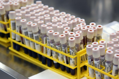 Um estudo desenvolvido por pesquisadores da Universidade Estadual de Maringá (UEM) busca identificar a reação cruzada entre testes positivos da dengue e da Covid-19.  -  Foto: UEM/SETI